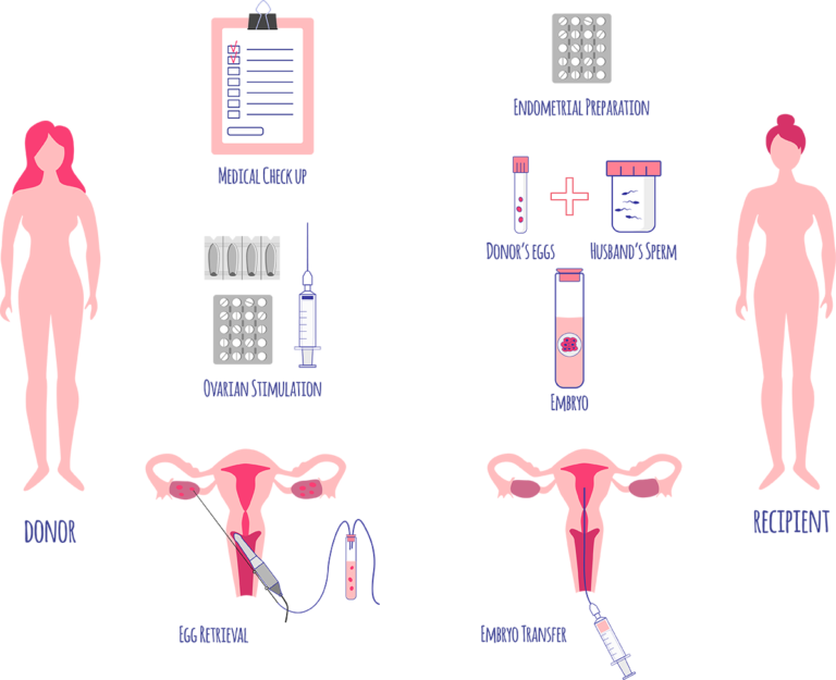 Synchronized Donor and Recipient Clinical Workflow for Egg and Sperm Donation